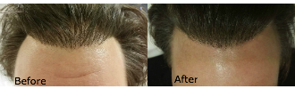Hair simulation from Natural Enhancement