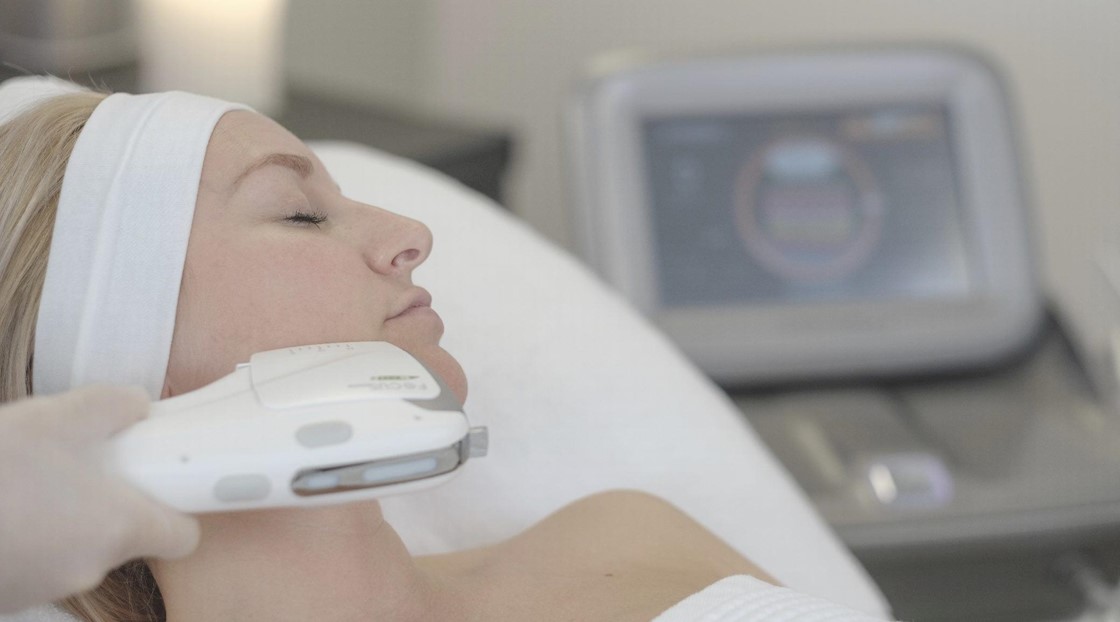 How to sculpt a defined jawline with RF microneedling and HIFU