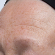 elemis ultra smart pro collagen serum