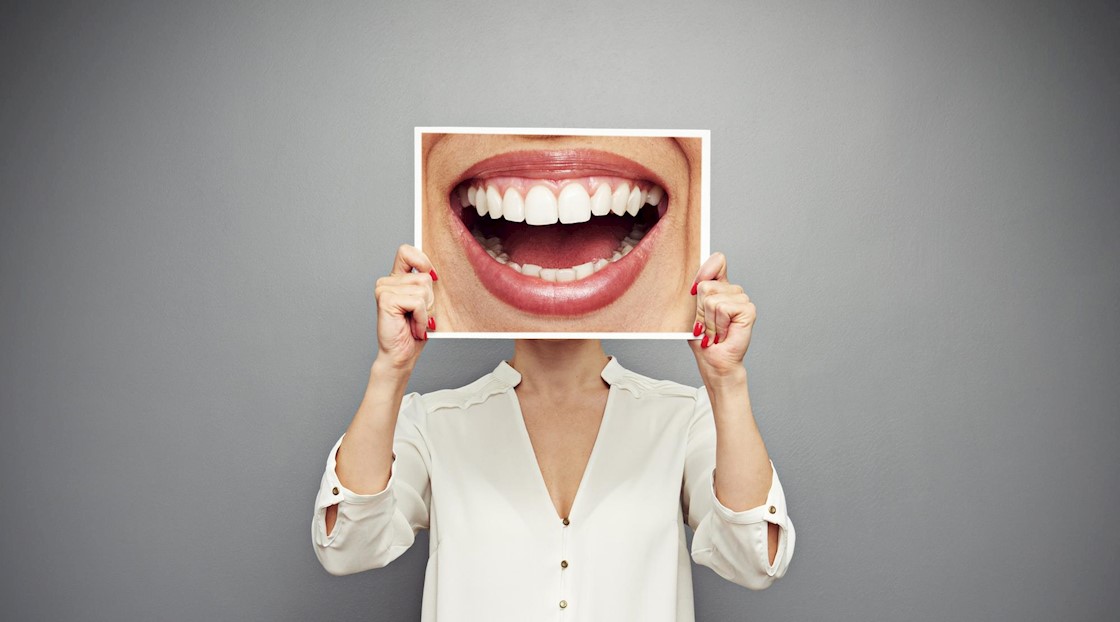 “Turkey teeth” trend Leading dental professor issues stark warning